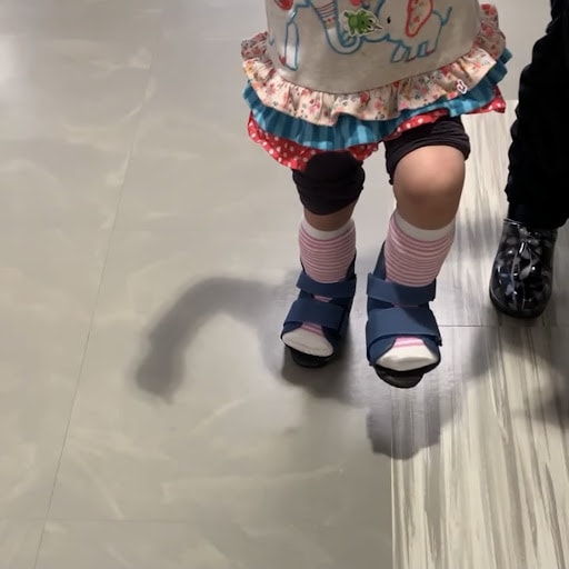 Toddler girl walking in serial casts